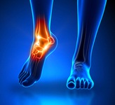 Ankle Foot Heel Pain