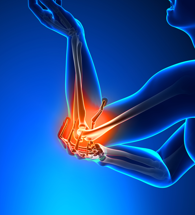 Image depicting elbow pain, possibly from Tennis Elbow or Golfer's Elbow