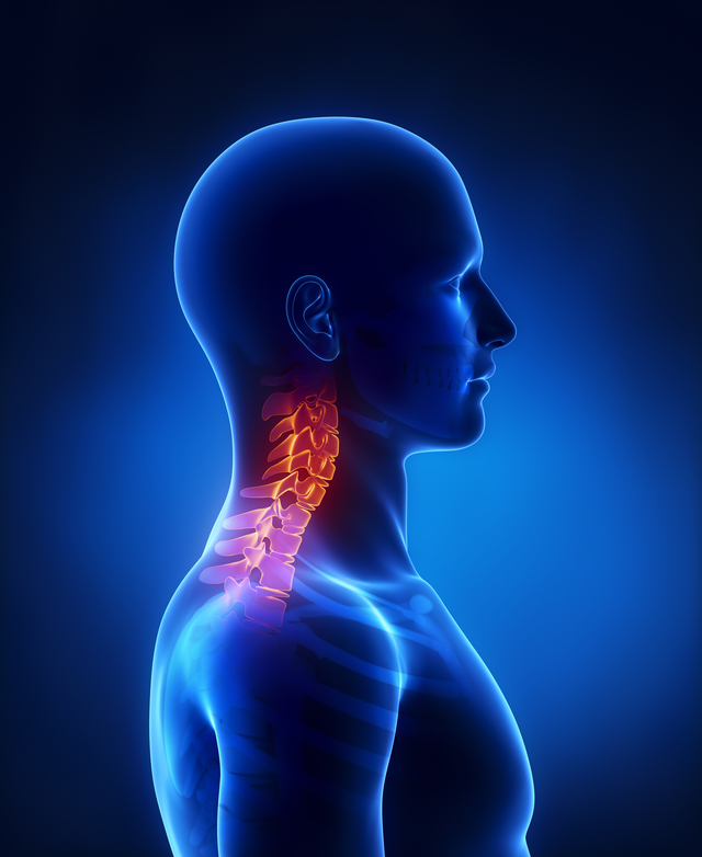 Image depicting neck pain