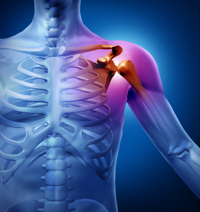 Image depicting shoulder pain